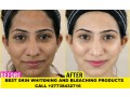 permanent-skin-lightening-skin-whitening-products-27738432716-small-3