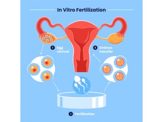 Top IVF Services at Dr. Ankita Fertility Center, Mumbai