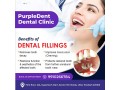 dental-clinic-in-noida-small-0